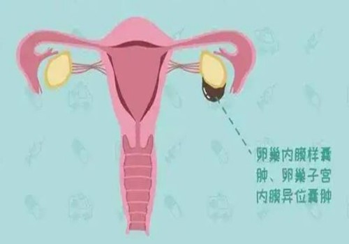 试管移植后卧床休息，三天内尽量不上班