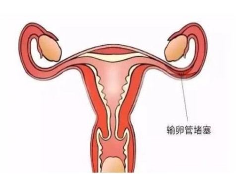 2022例假一直不来，这是推迟了还是怀孕了-