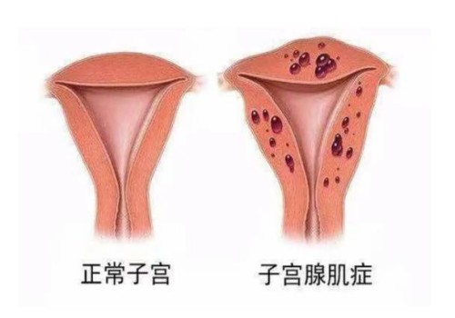 杭州助孕公司：男性弱精应该怎么调养，掌握四个方法调理弱精